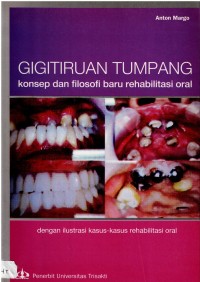 Gigitiruan Tumpang : Konsep dan Filosofi Baru Rehabilitasi Oral