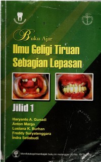 Buku Ajar : Ilmu Geligi Tiruan Sebagian Lepas