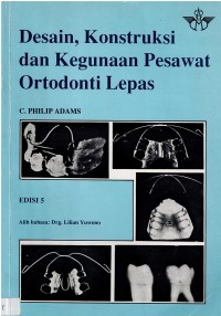 Desain, Konstruksi dan Kegunaan Pesawat Ortodonti Lepas