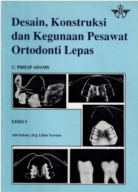 Desain, Konstruksi dan Kegunaan Pesawat Ortodonti Lepas