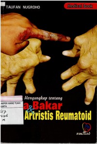 Mengungkap tentang :  Luka Bakar dan Artritis Reumatoid